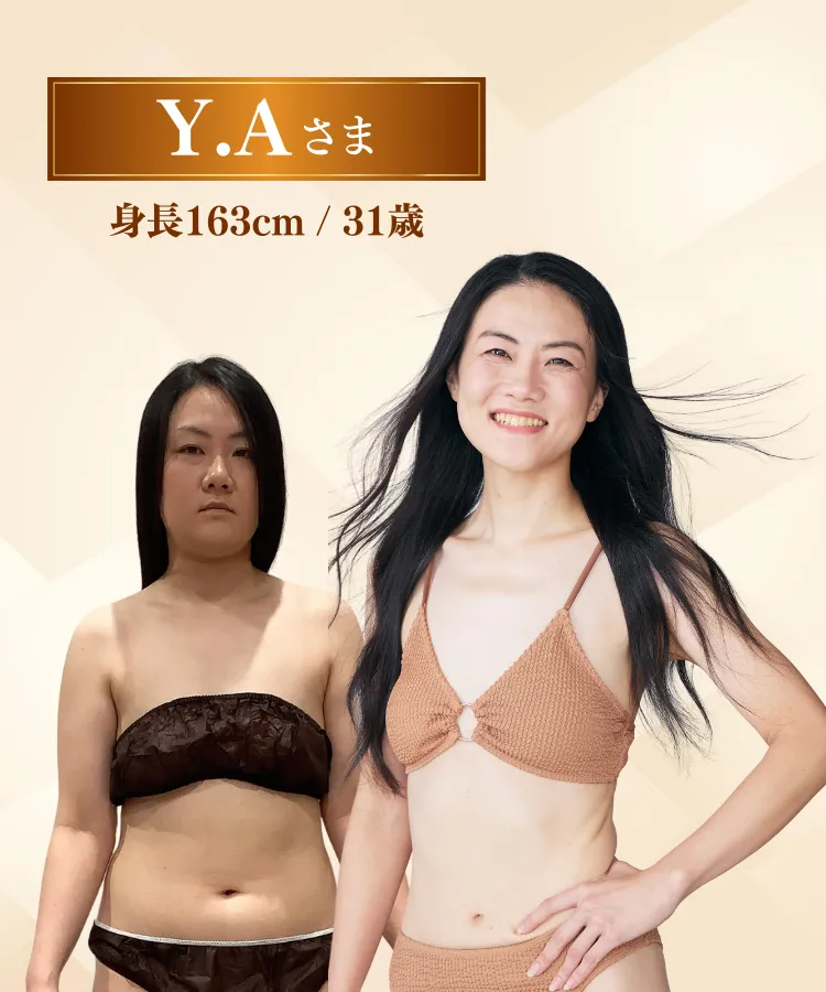 mv