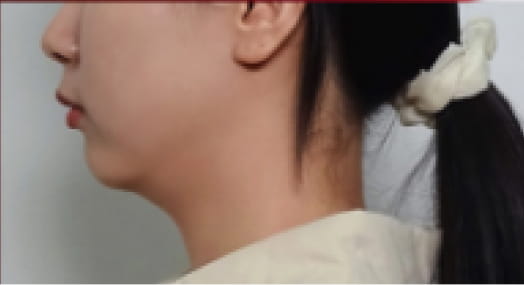 術前