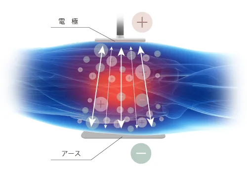 Physio Radiostim Proとは