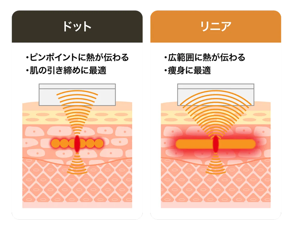 ULTRAcel [zíː]の強み