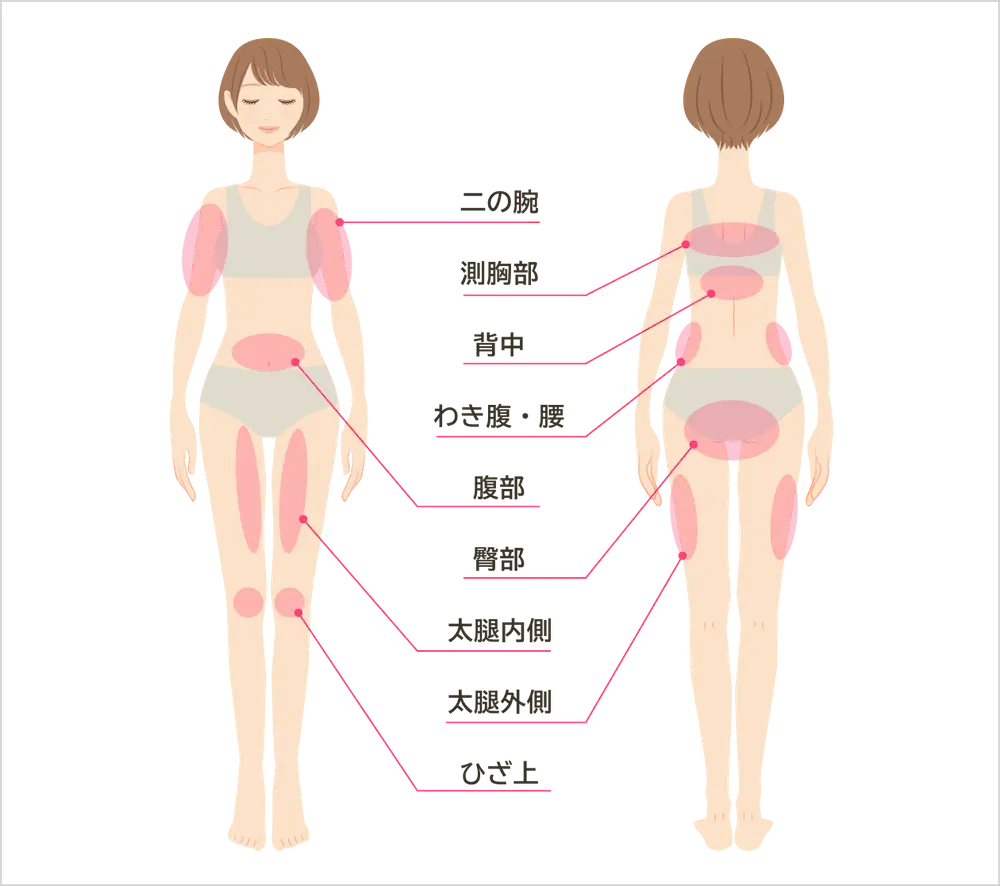 脂肪冷却ができる部位