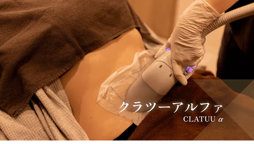 クラツーアルファ