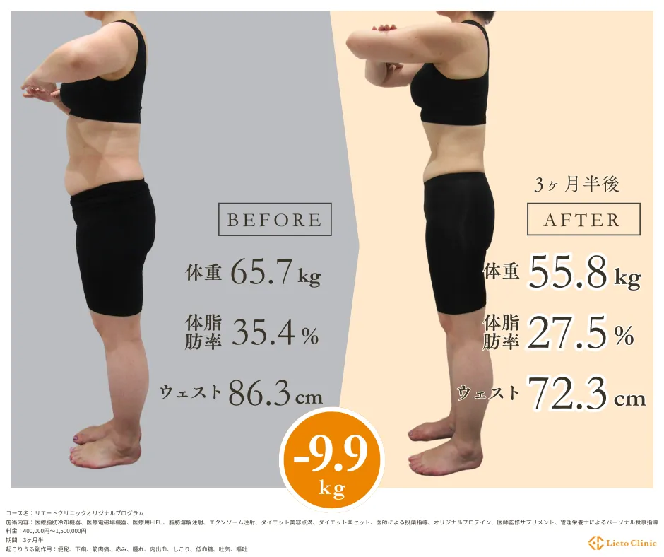 症例【50代女性 / -9.9kg / 164cm】