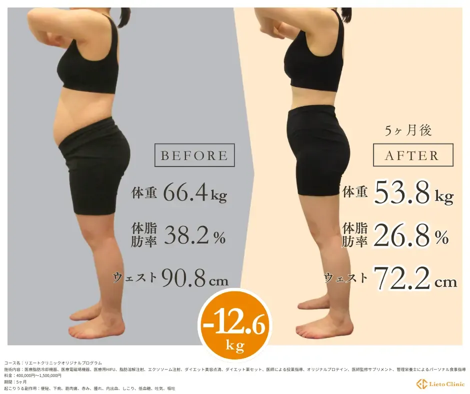 50代女性 / -12.6kg / 154cm