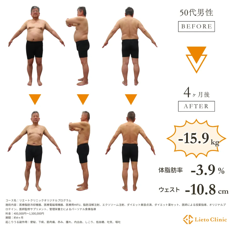症例:K.Aさん(仮名)(50代男性)