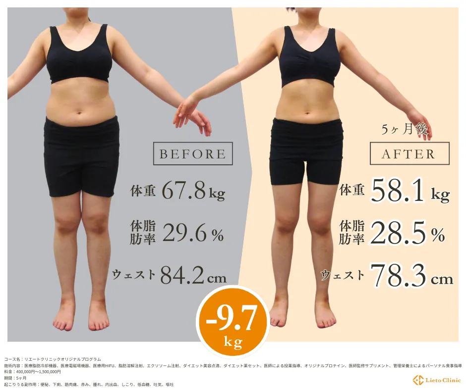 症例【20代女性 / -9.9kg / 身長164cm】