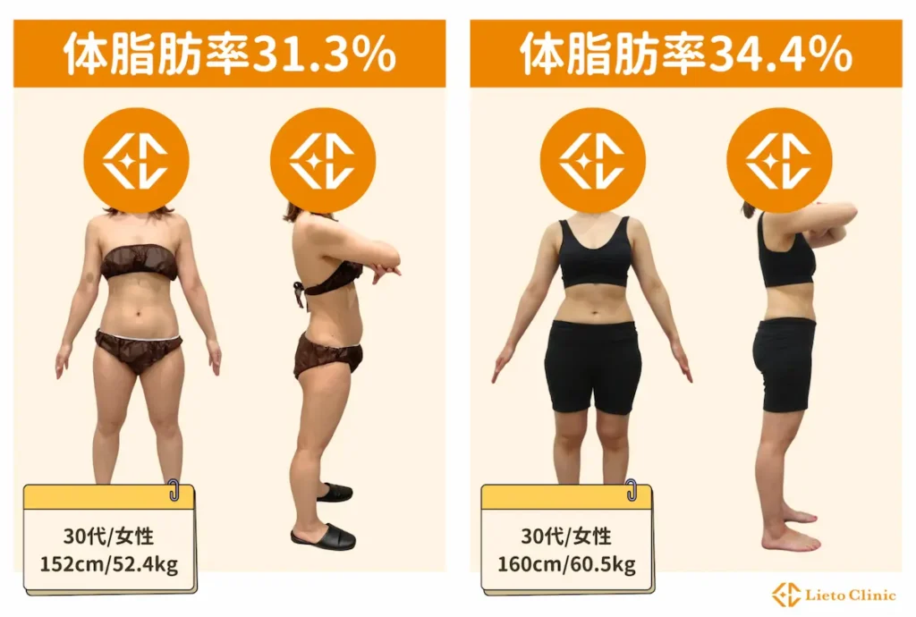 体脂肪率30~35%の女性
