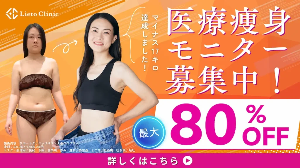 医療痩身モニター募集中!最大80%オフ