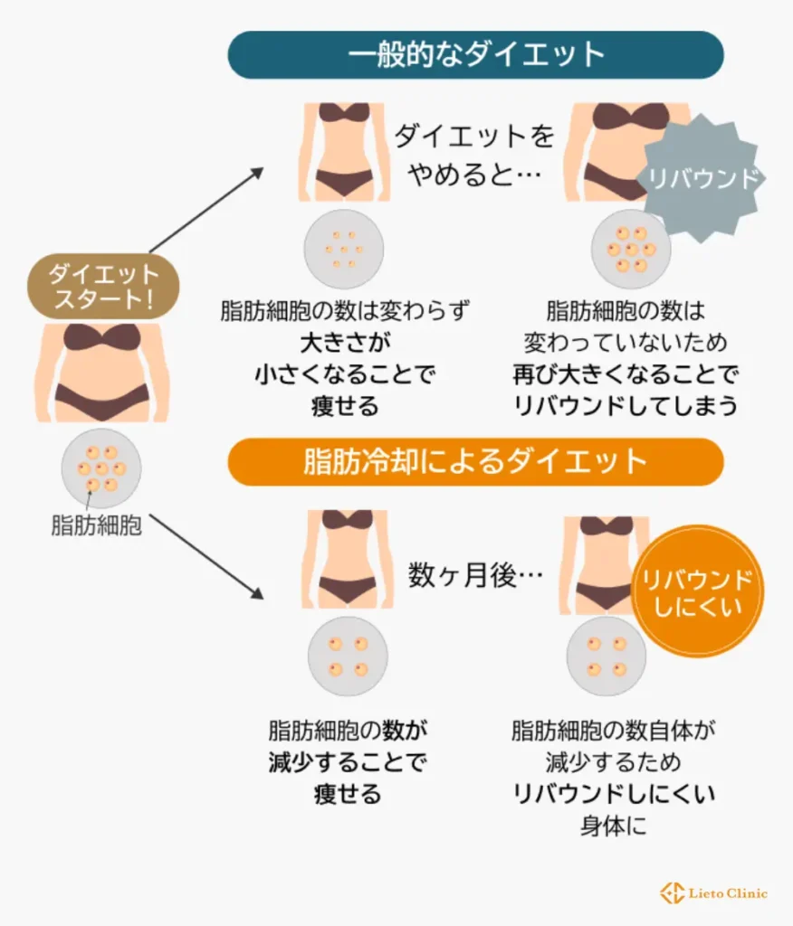 脂肪冷却とダイエットの違い