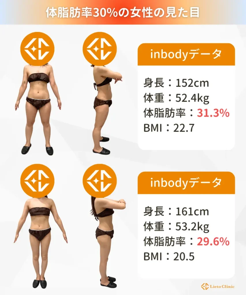 体脂肪30%の女性の見た目