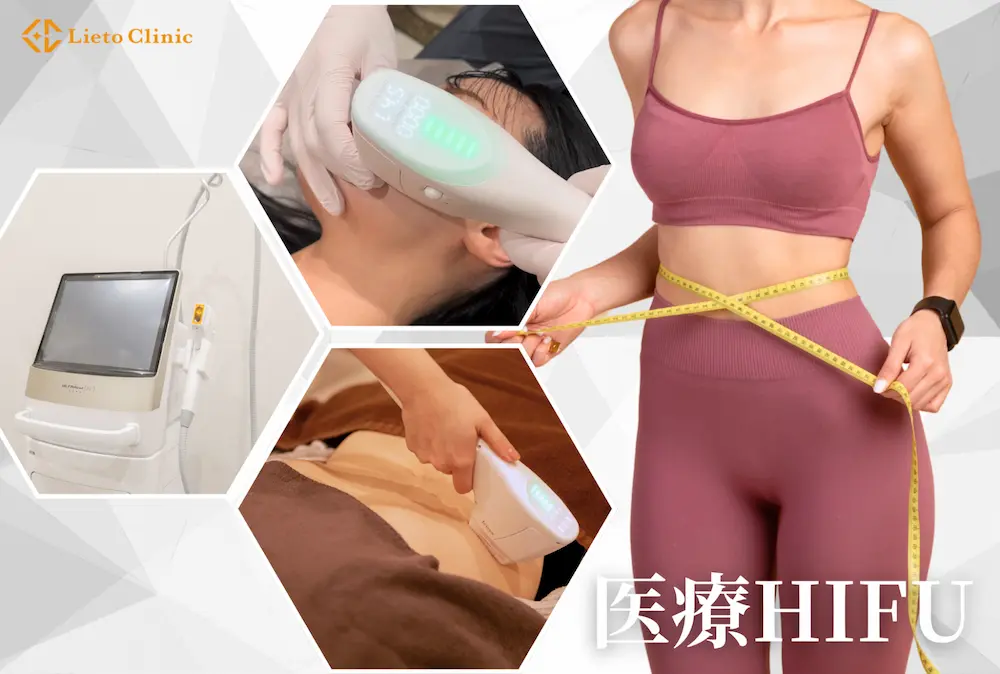 医療HIFU