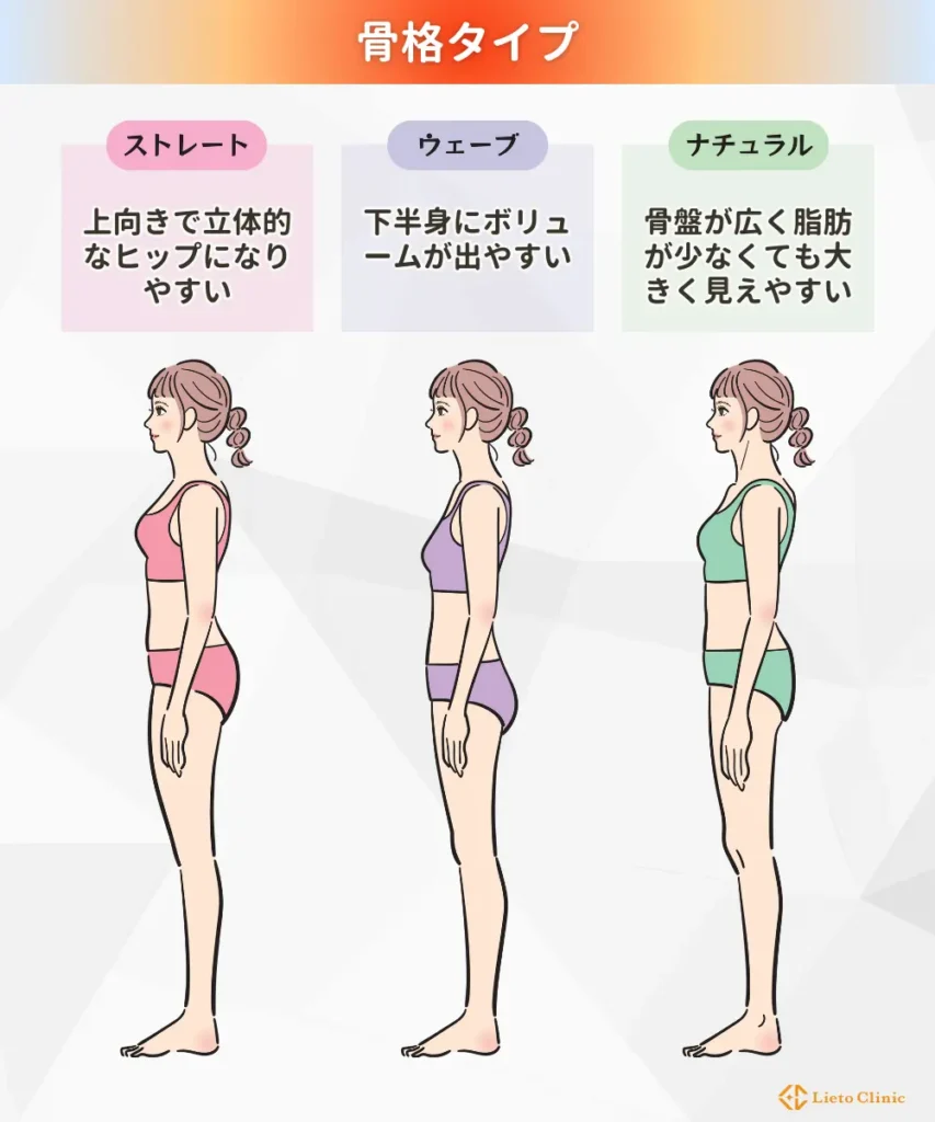 骨格タイプ