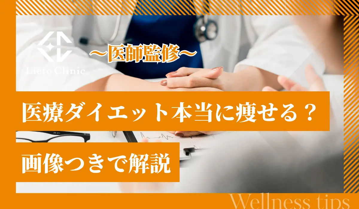 医療ダイエット本当に痩せる？画像つきで解説