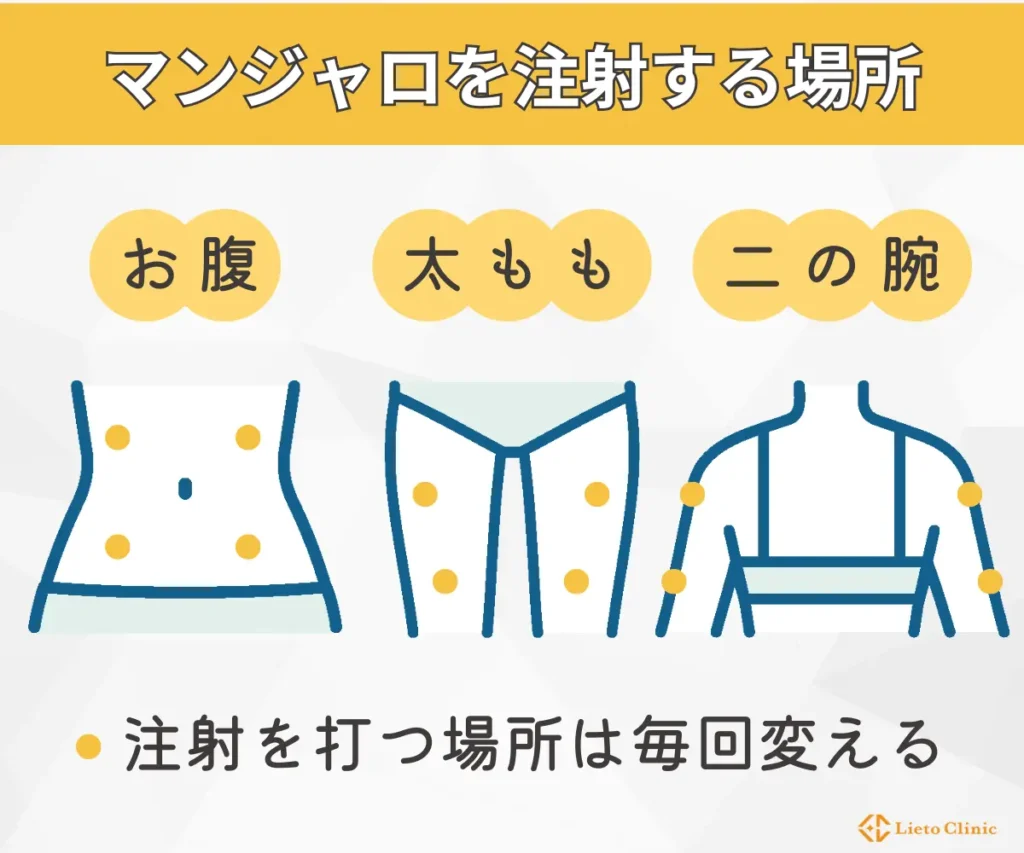 マンジャロを注射する部位